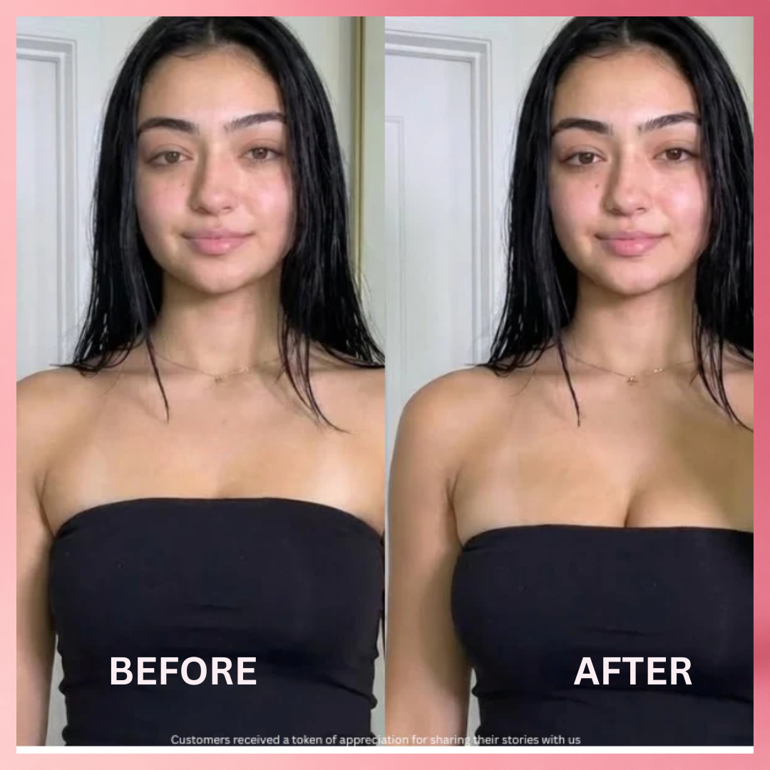 Recupere su firmeza y confianza naturales – Sin cirugía
