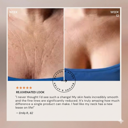 Lunelle CollaLift™ - Naturally Lifted, Firmer & Fuller - No Surgery, No Fillers.